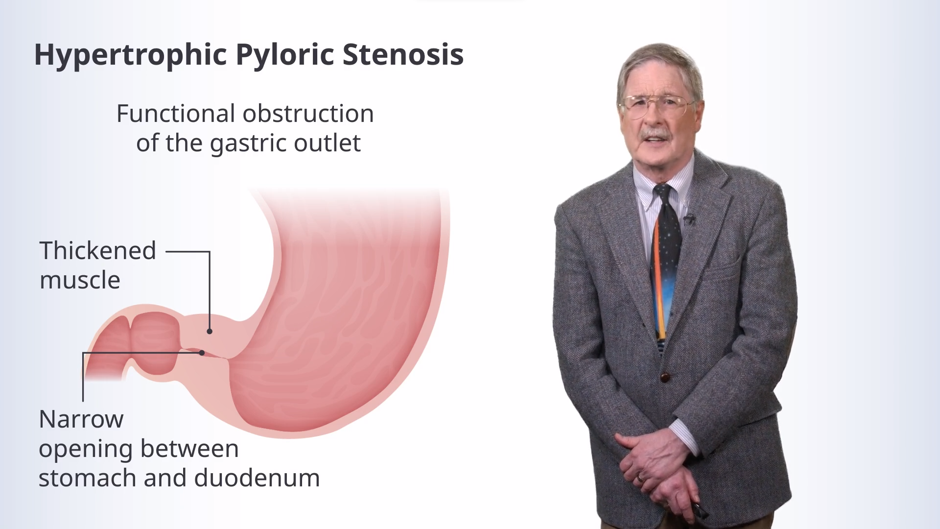 Disorders Of The Stomach Online Pathology Course Lecturio