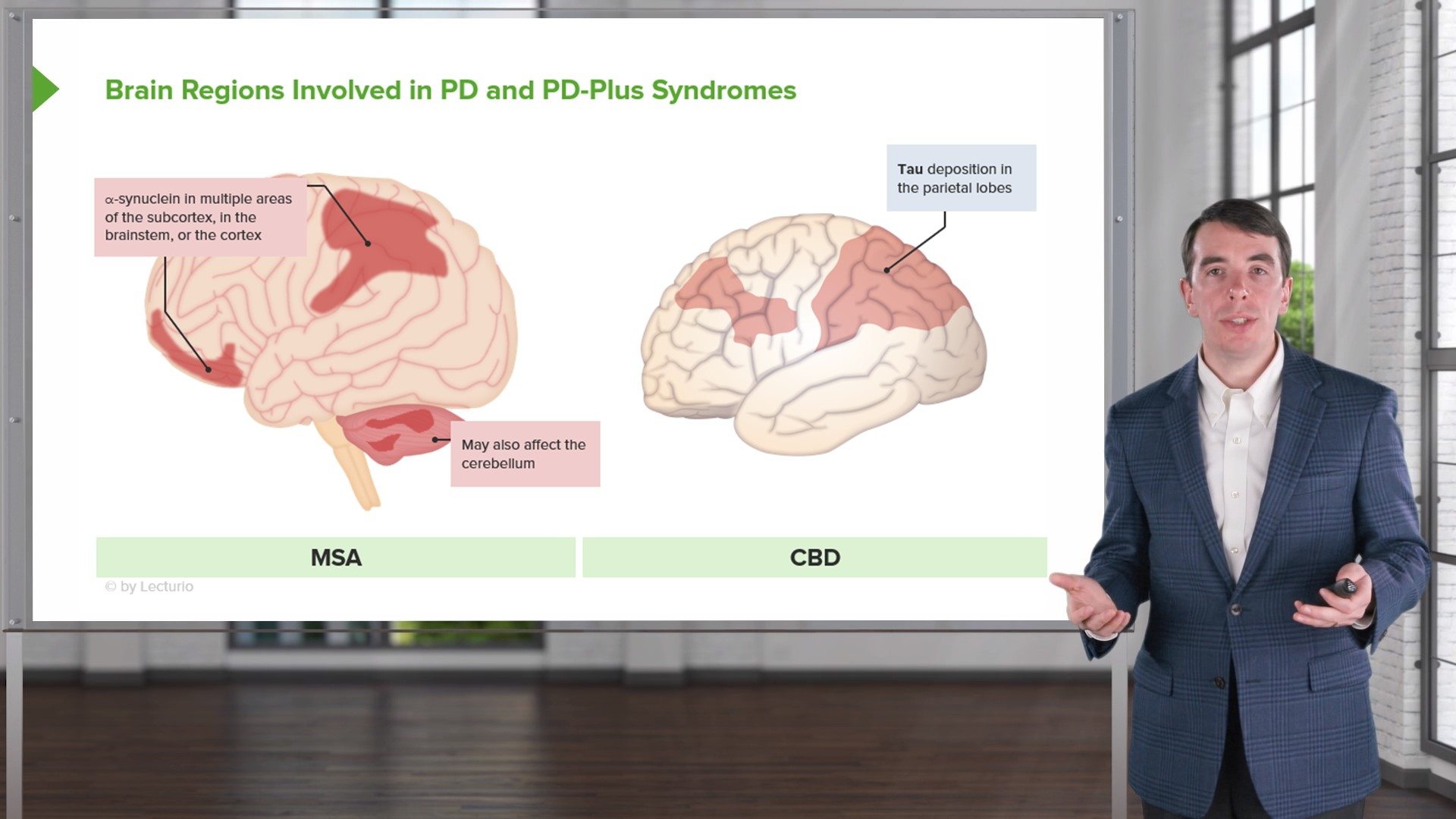 Parkinson-Plus Syndromes: Introduction – Online Neurology Lecture