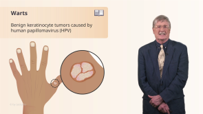 Infection Conditions of the Skin