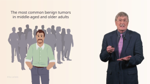 Benign Epithelial Tumors of the Skin