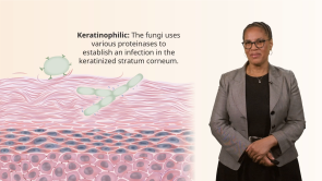 Fungal Skin Infections in Patients with Darker Skin
