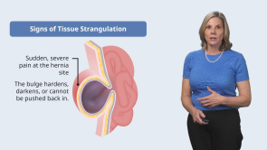 Management of Gastrointestinal System Disorders in the Older Adult