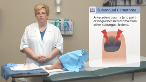 Pressure Relief Procedures in Primary Care