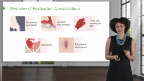 Postpartum Complications (Nursing)