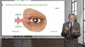 External Eye Diseases