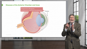 Diseases of the Anterior Chamber and Uvea
