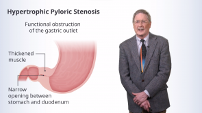 Disorders of the Stomach