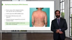 Infectious Skin Diseases