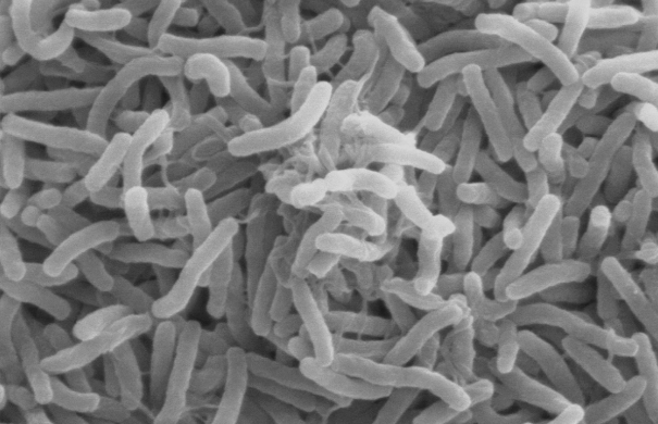 mykoplasmen-bakterien-Cholera_bacteria_SEM.jpg