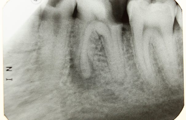 Dental_X-ray_2012_PD_06.JPG