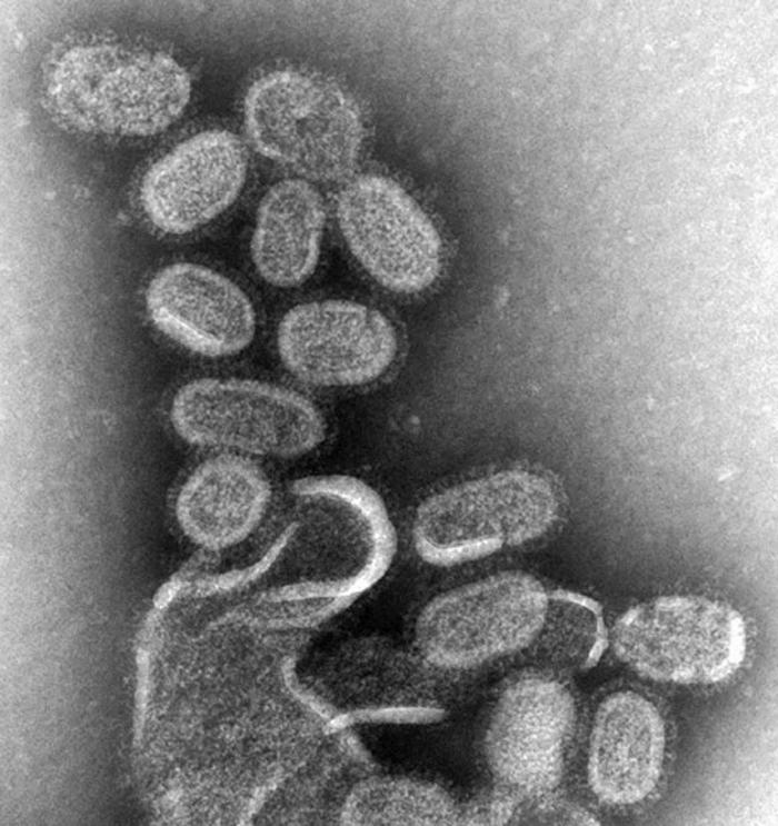 Grippe_Virus_EM_of_influenza_virus.jpg