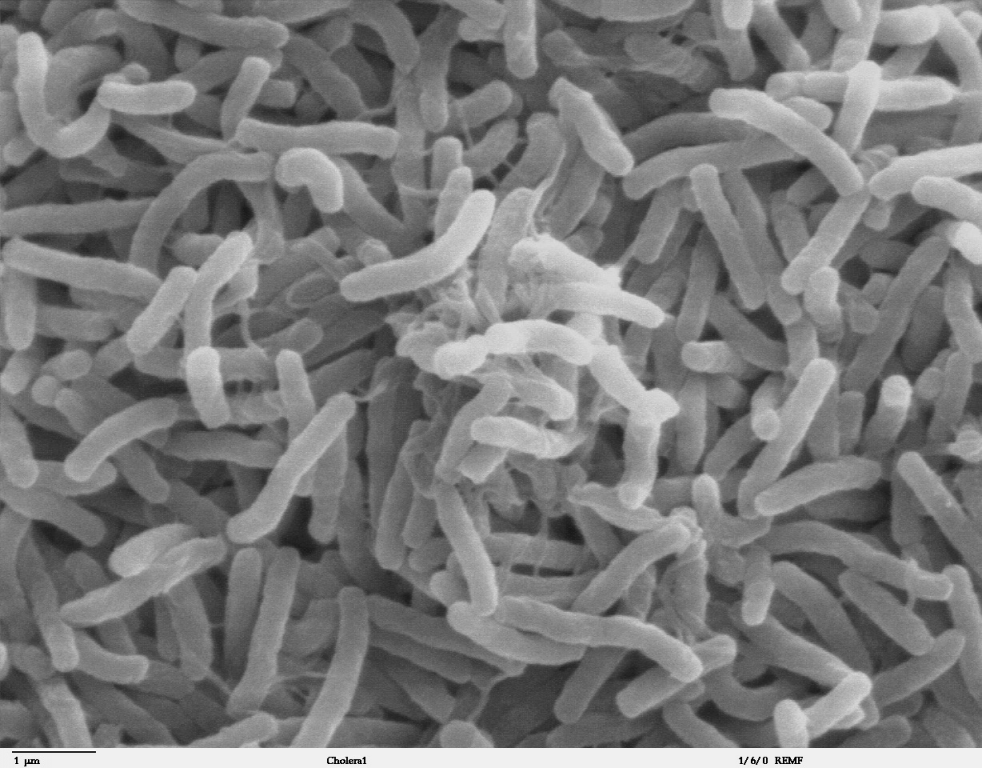 mykoplasmen-bakterien-Cholera_bacteria_SEM.jpg