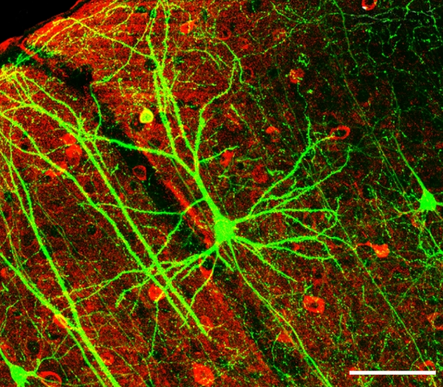 neuralgie-nervenschmerz-PLoSBiol4.e126.Fig6fNeuron.jpg