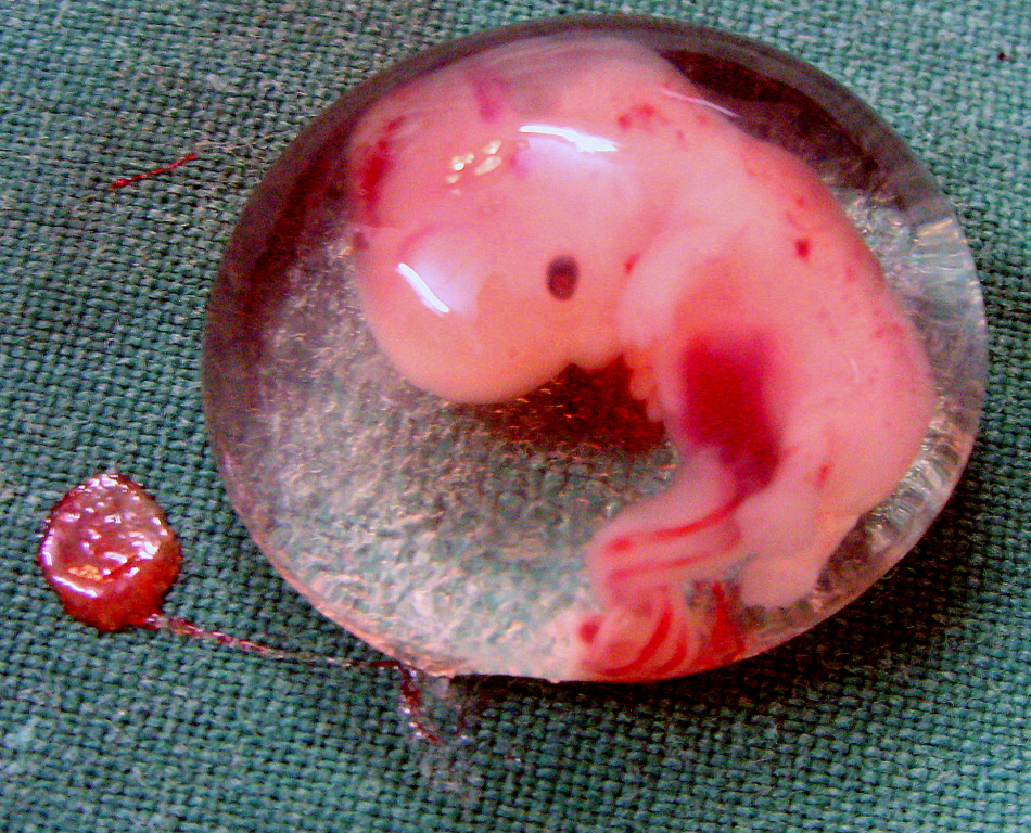 Human_Embryo_-_(cropped).JPG